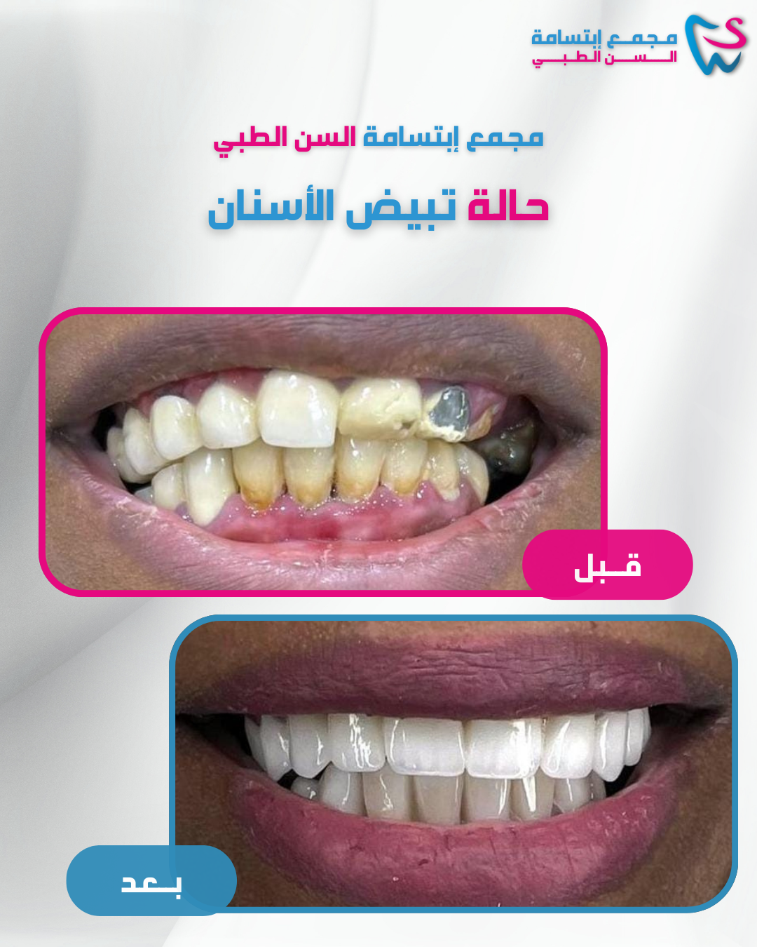 مـجمــع إبتسامة الـــسـن الــطـبـــي (4)
